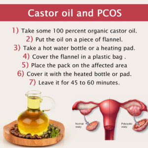 castor-oil-for-pgos